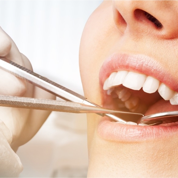 teeth getting examined